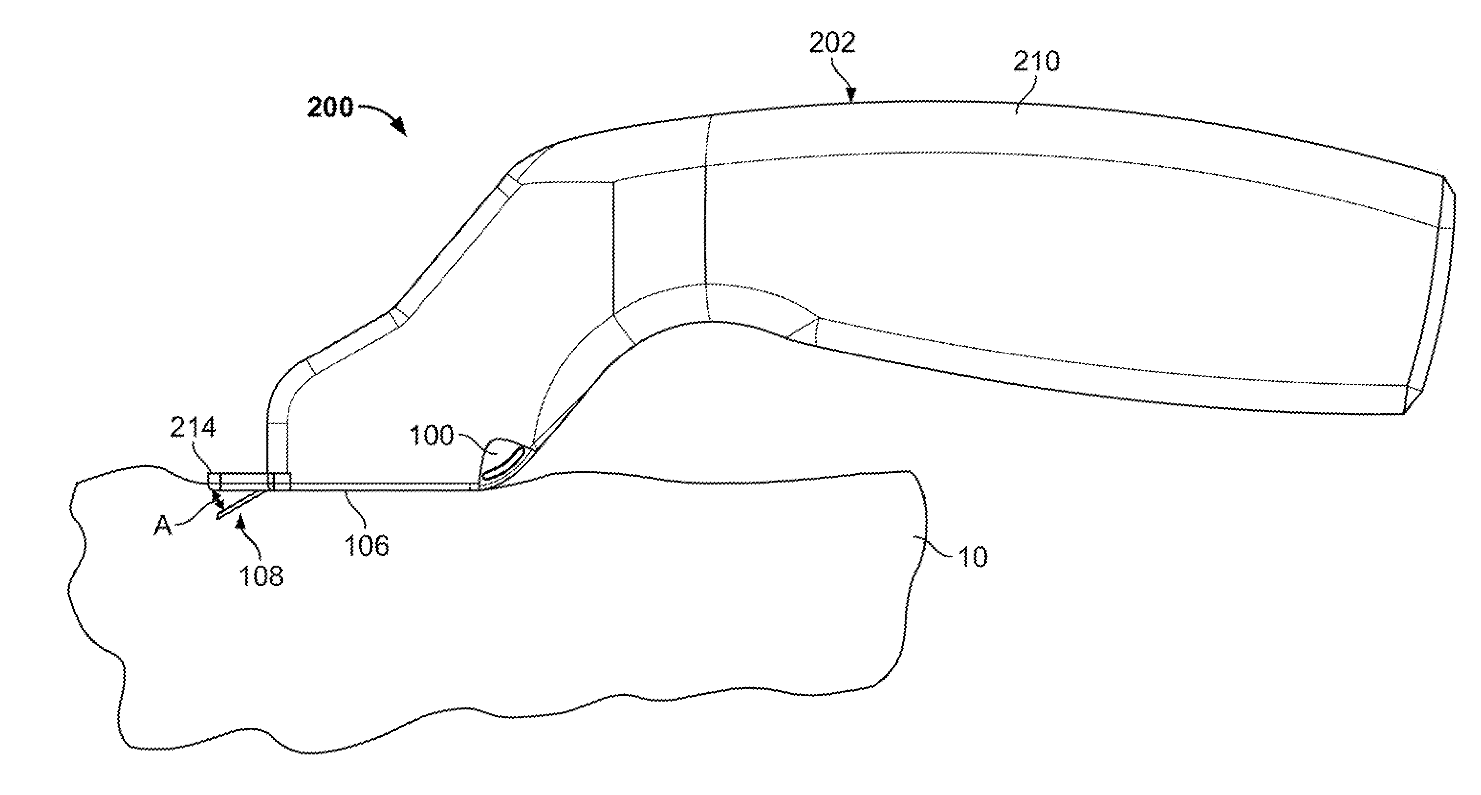 Devices and methods for percutaneous energy delivery