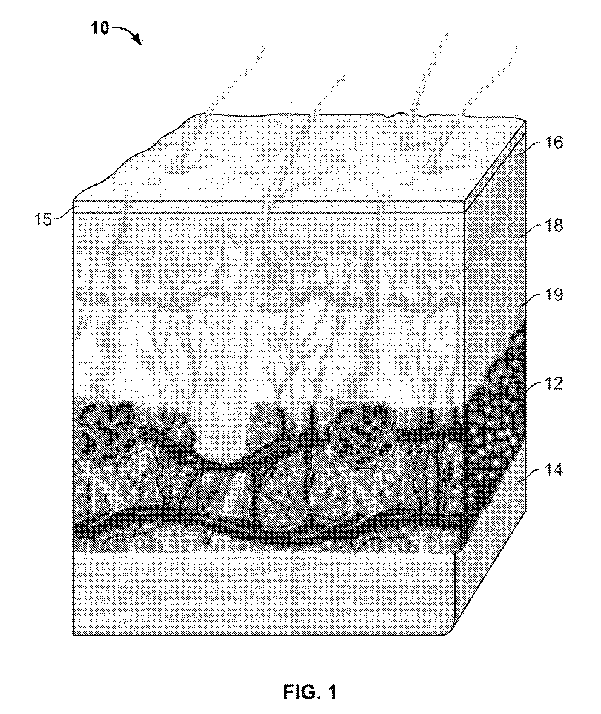 Devices and methods for percutaneous energy delivery