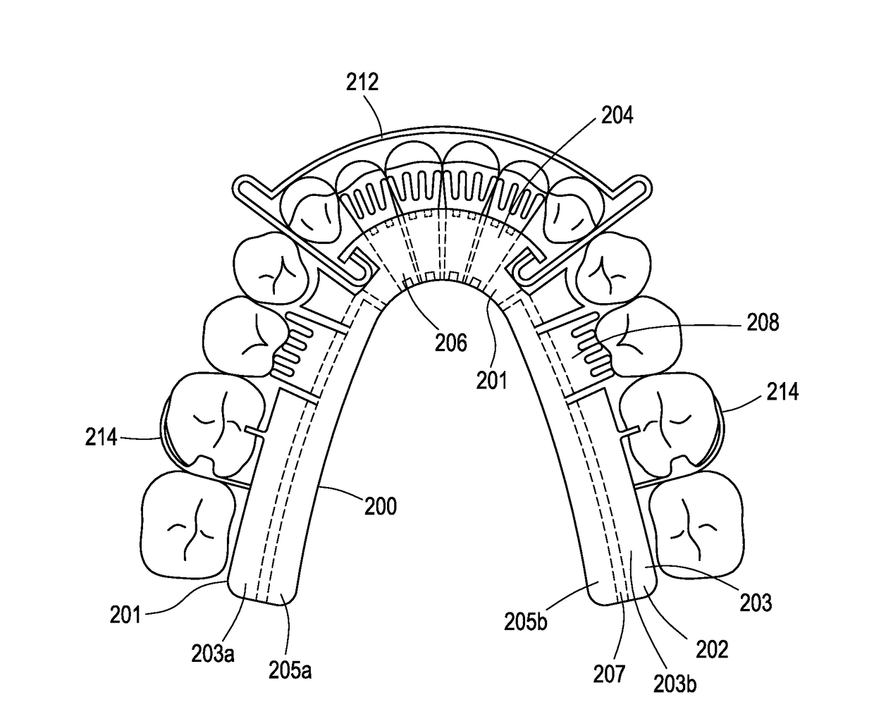 Orthodontic assembly