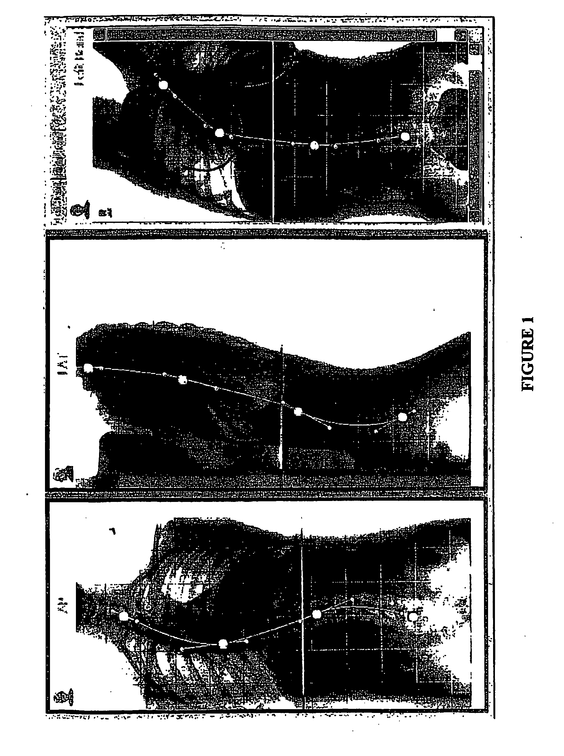 Systems and methods for multi-dimensional characterization and classification of spinal shape