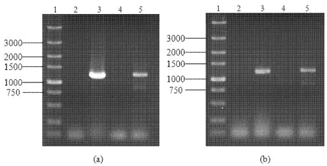 Brewing yeast engineering bacteria containing Lg-ATF1 genes