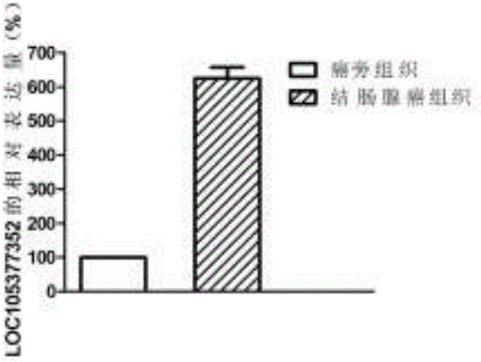 Molecular marker for colon adenocarcinoma