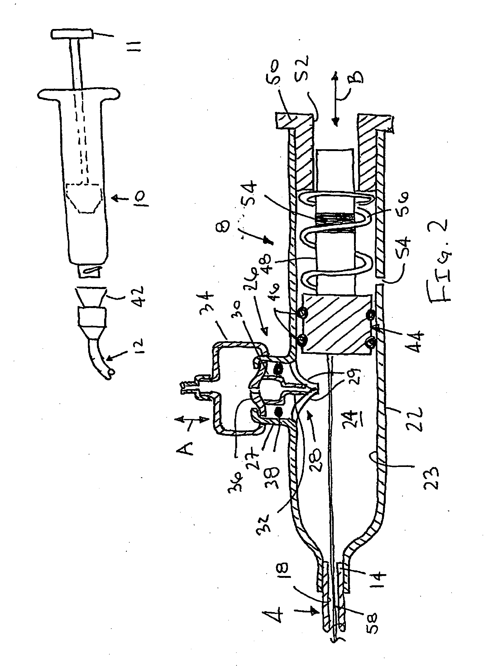 Apparatus and method for temporary hemostasis