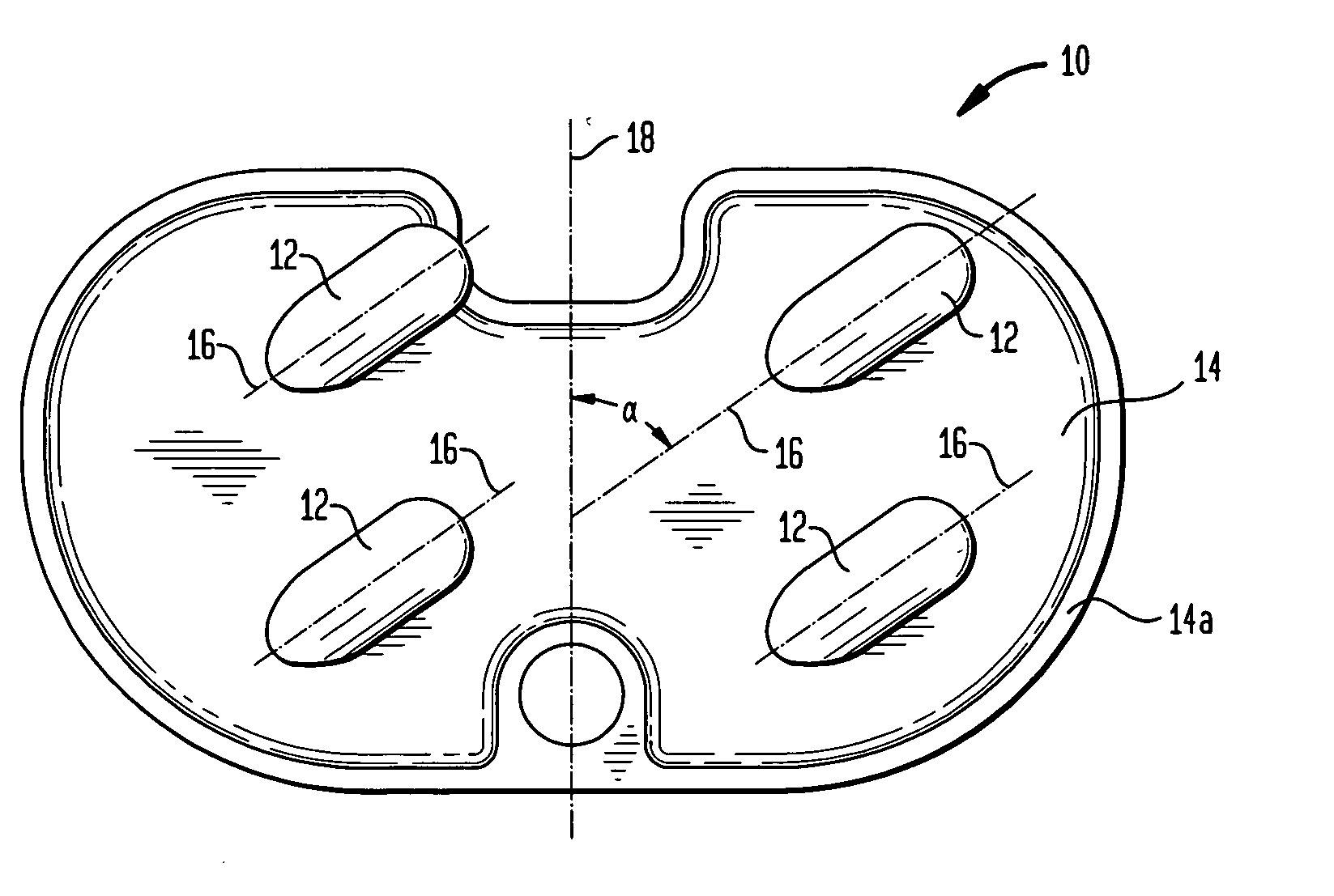 Orthopedic implant with angled pegs