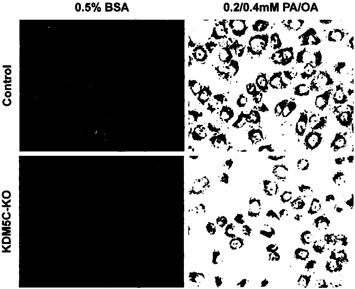 Application of histone demethylase KDM5C (lysine(K) demethylase 5C) in screening of drugs for treating the fatty liver and related diseases of the fatty liver