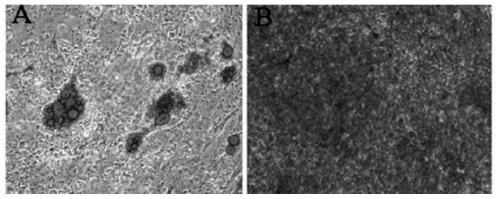 Method for preparing adipose-derived stem cell exosomes, adipose-derived stem cell exosomes and application thereof