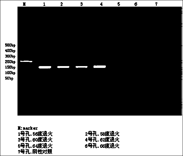 Noninvasive helicobacter pylori gene detection kit and preparation and detection method thereof