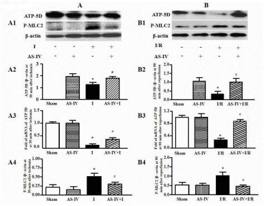 Protection effects of Astragaloside on heart