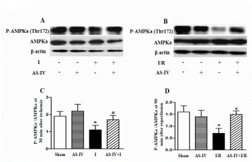 Protection effects of Astragaloside on heart