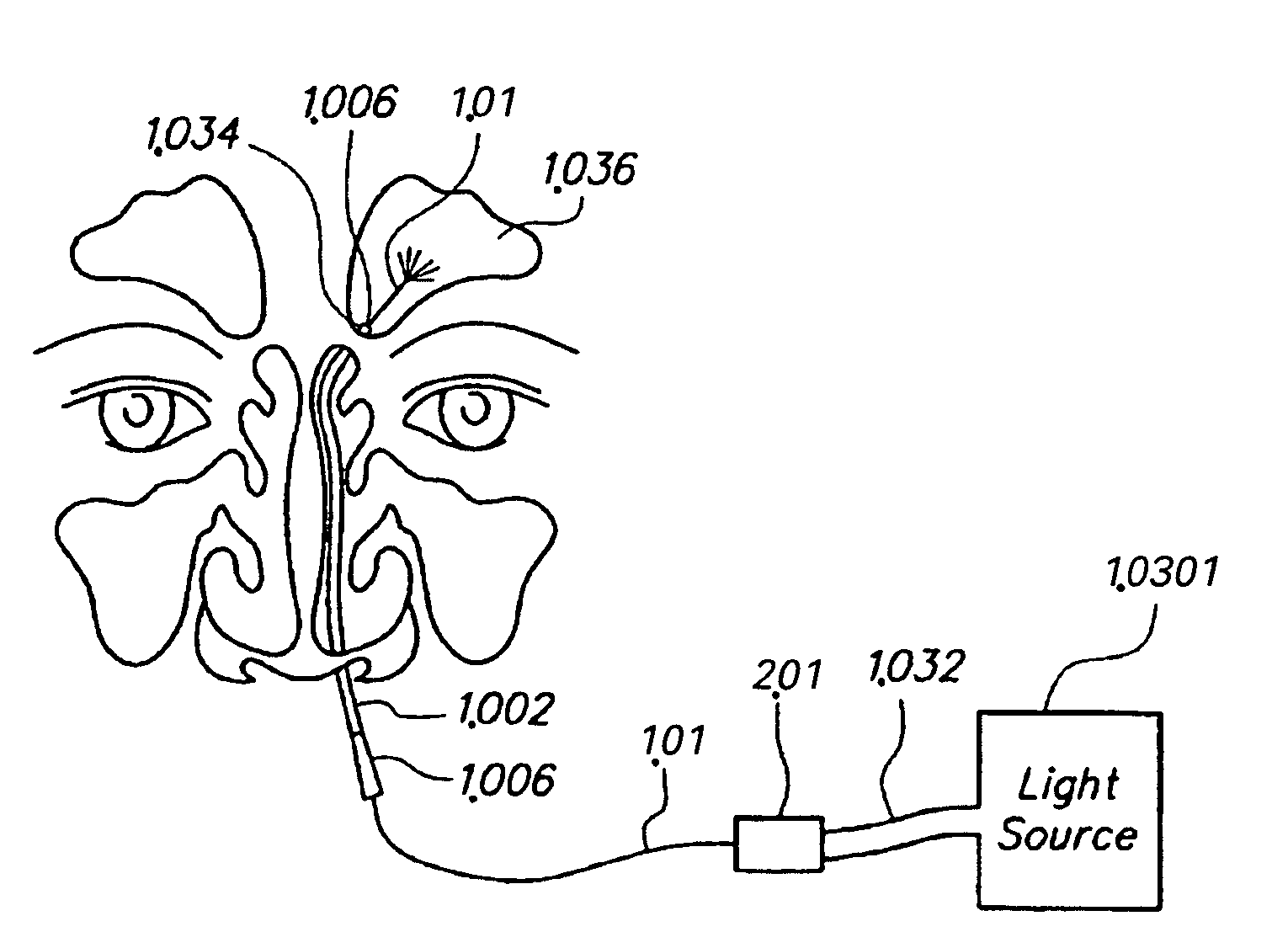 Devices, systems and methods for diagnosing and treating sinusitis and other disorders of the ears, Nose and/or throat