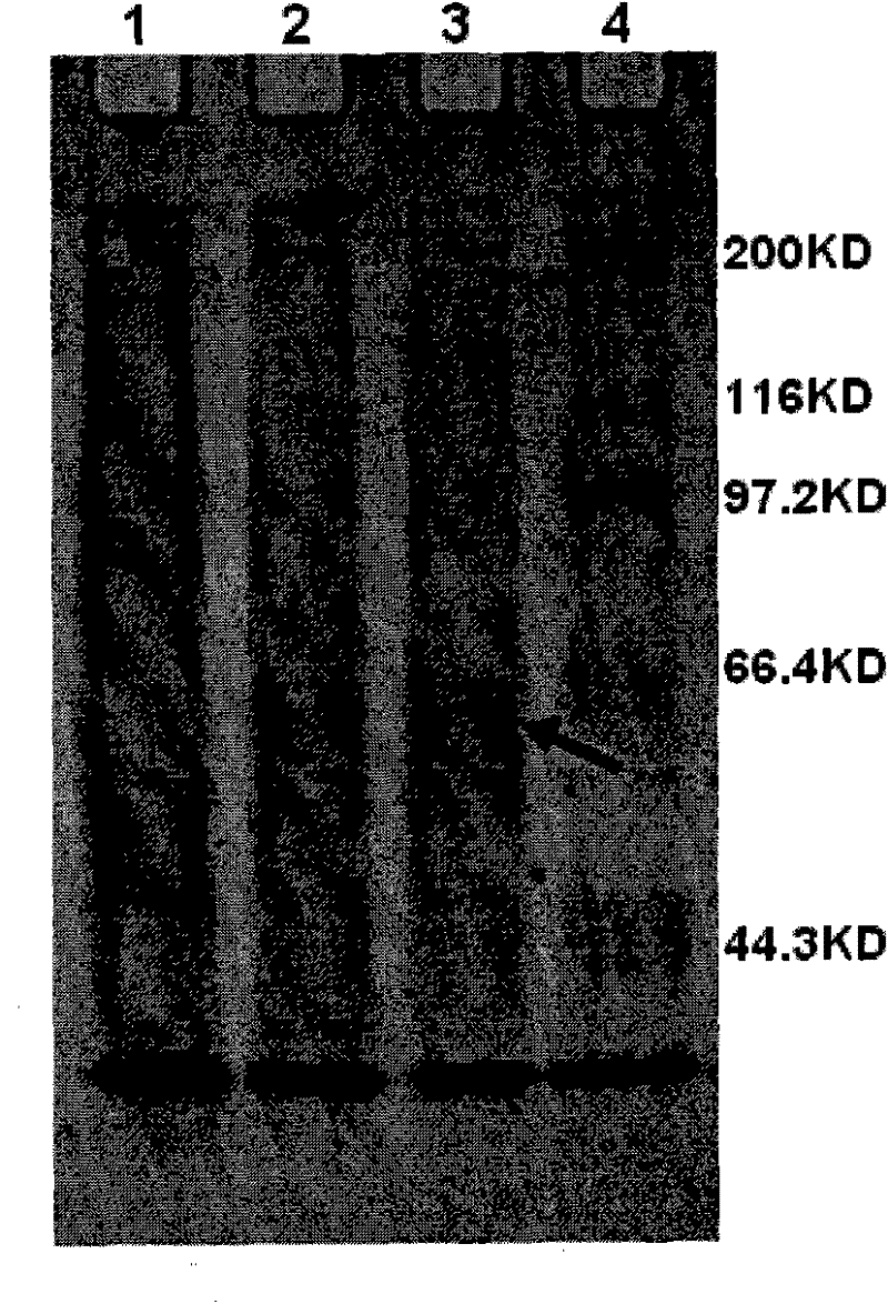 Expression and application of human papilloma viruses type 16 and 18 L1 proteins in inset cells