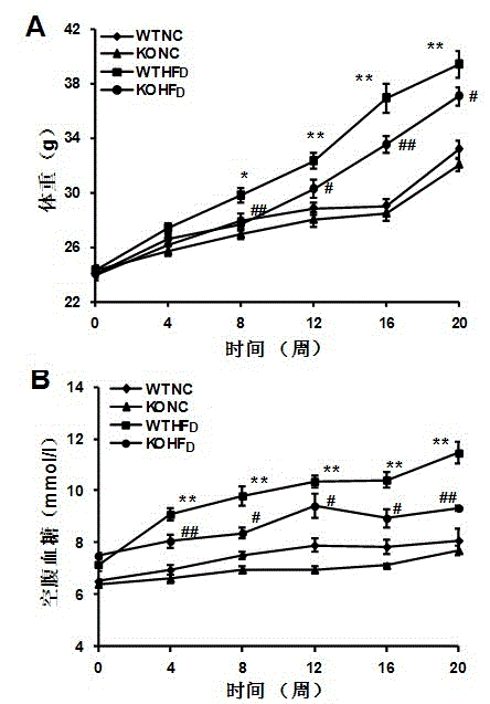 Function and application of tumor necrosis factor (TNF) receptor associated factor 1 (TRAF1) in treatment of fatty liver and diabetes mellitus II