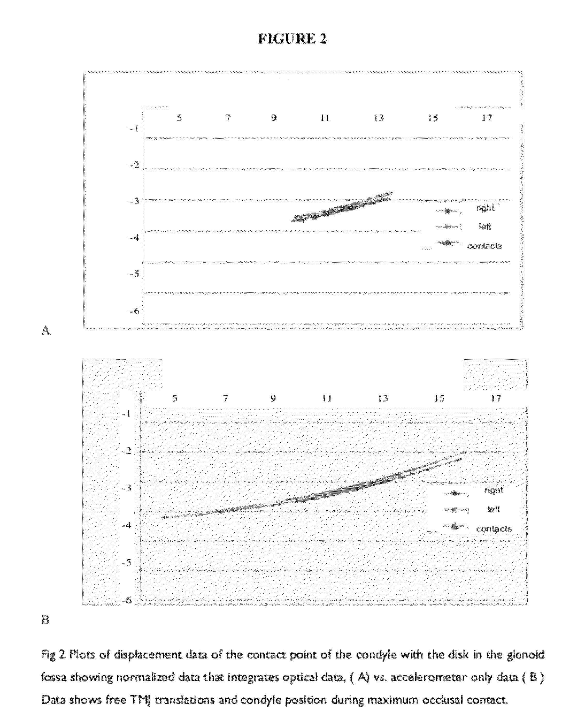 System and method for automated manufacturing of dental orthotics