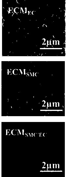 Method of constructing multi-functional biomimetic modified layer on surface of cardiovascular implant material based on vascular basement membrane structure