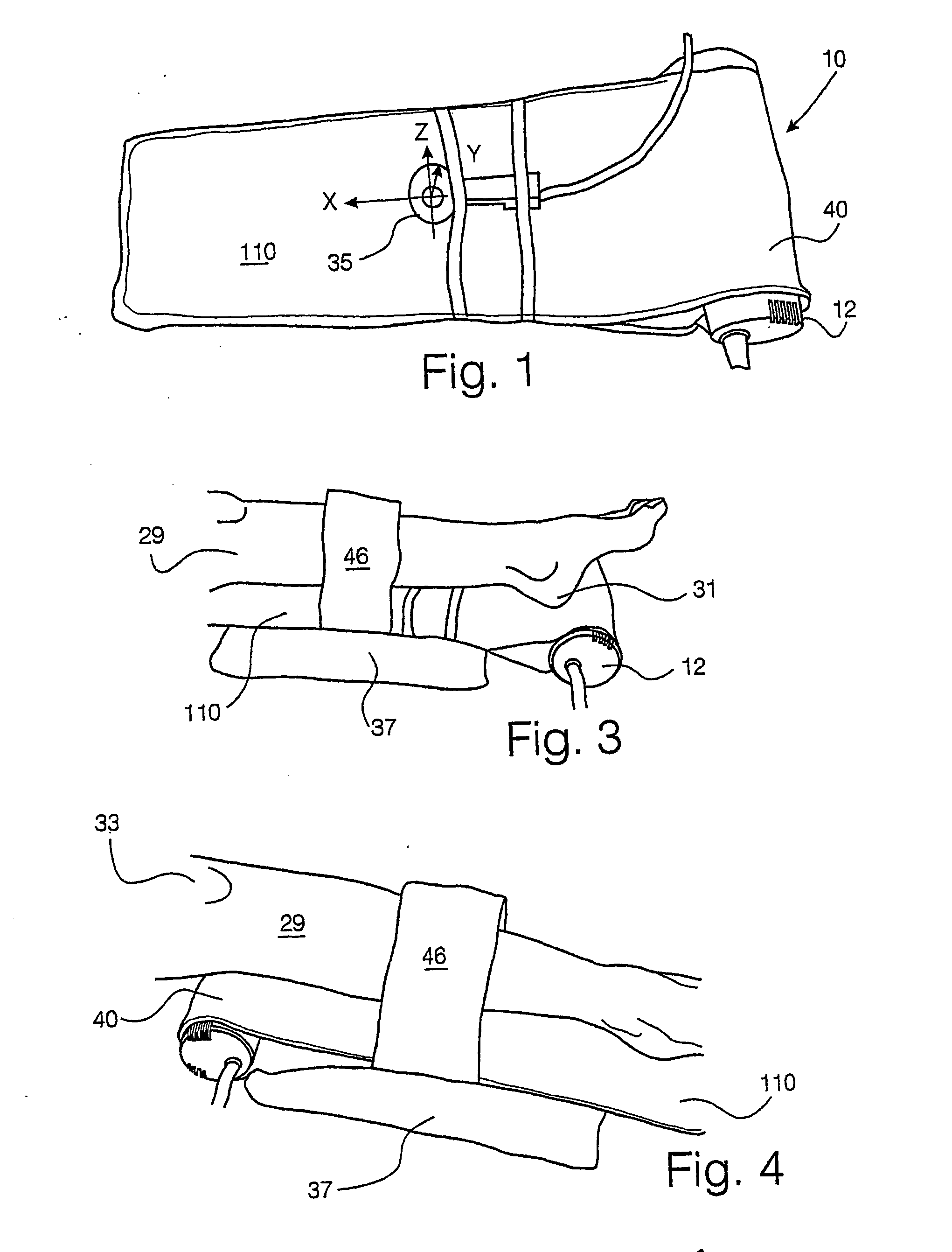 Leg ulcer, lymphoedema and DVT vibratory treatment and device