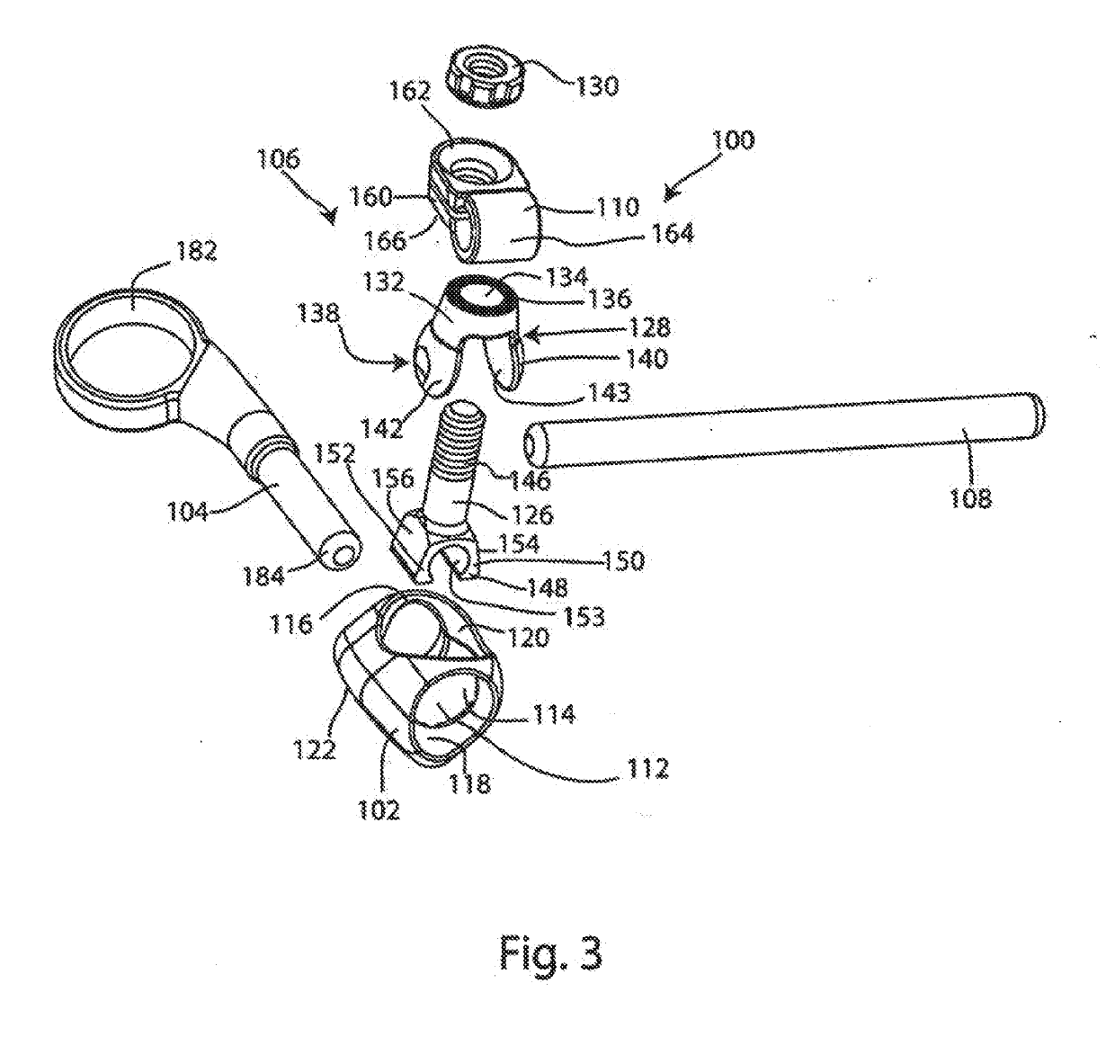 System and method for facet joint replacement