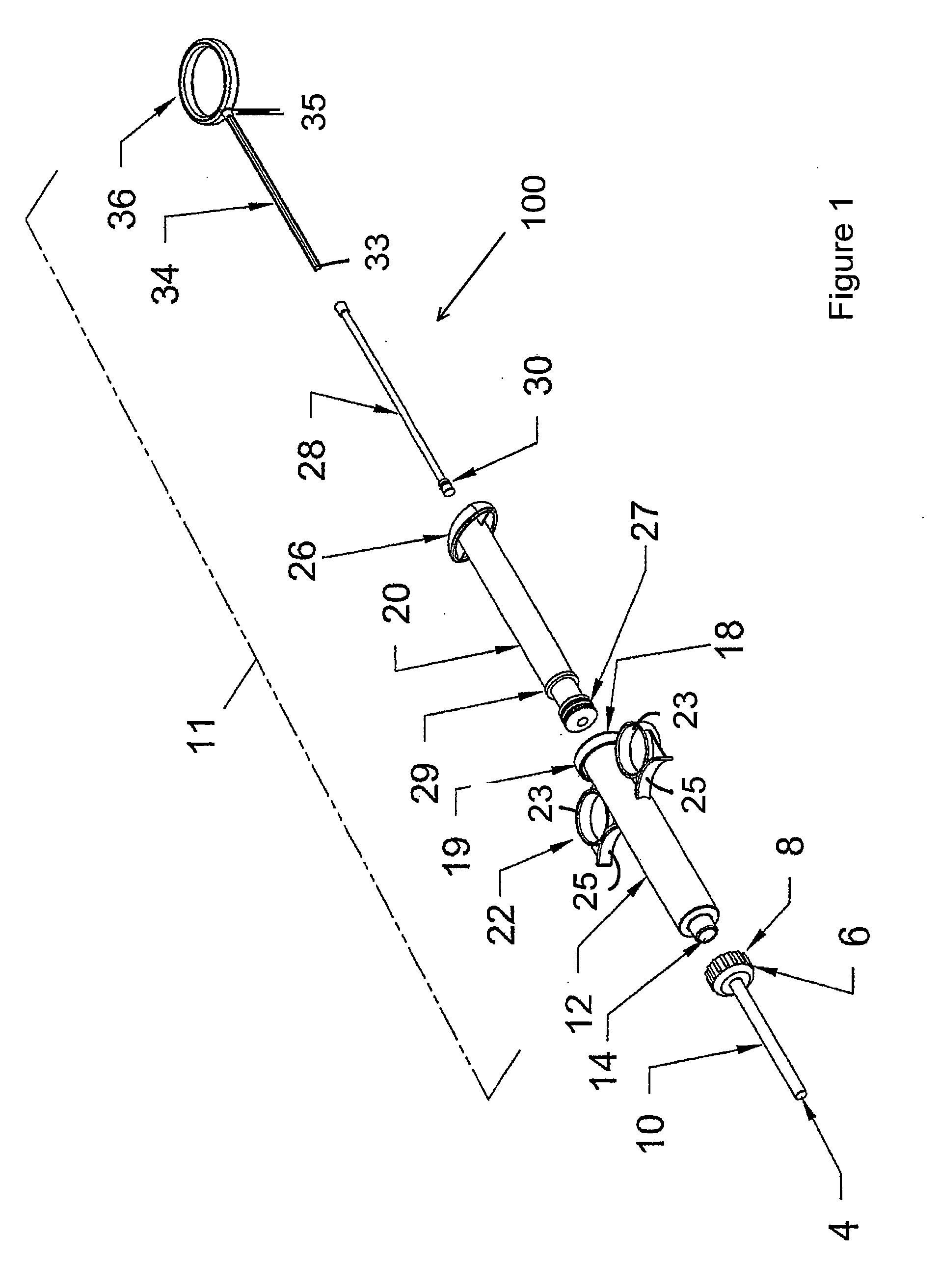 High viscosity material delivery system