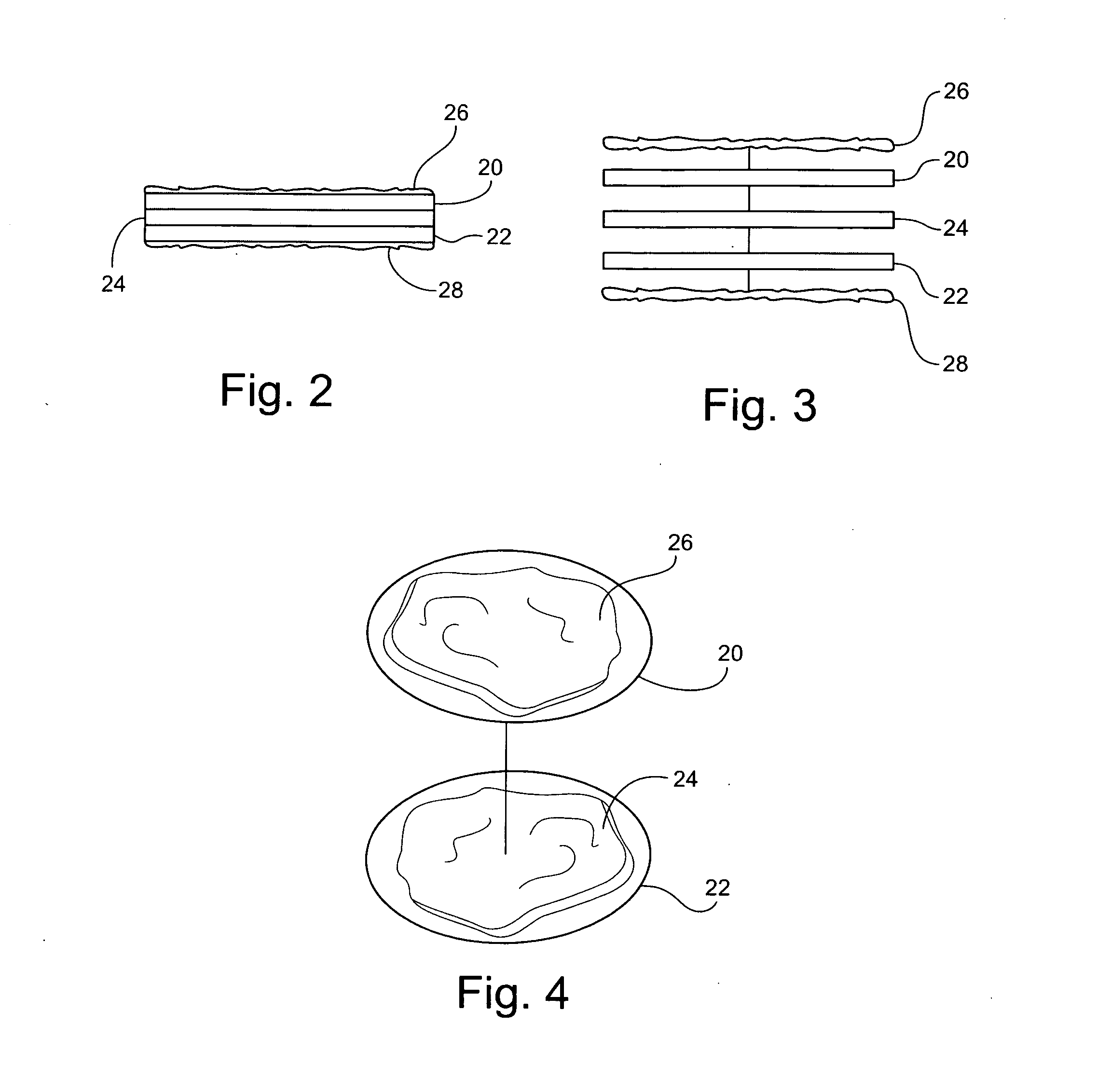 Prosthodontic tool and method for placing and fitting crowns and inlays