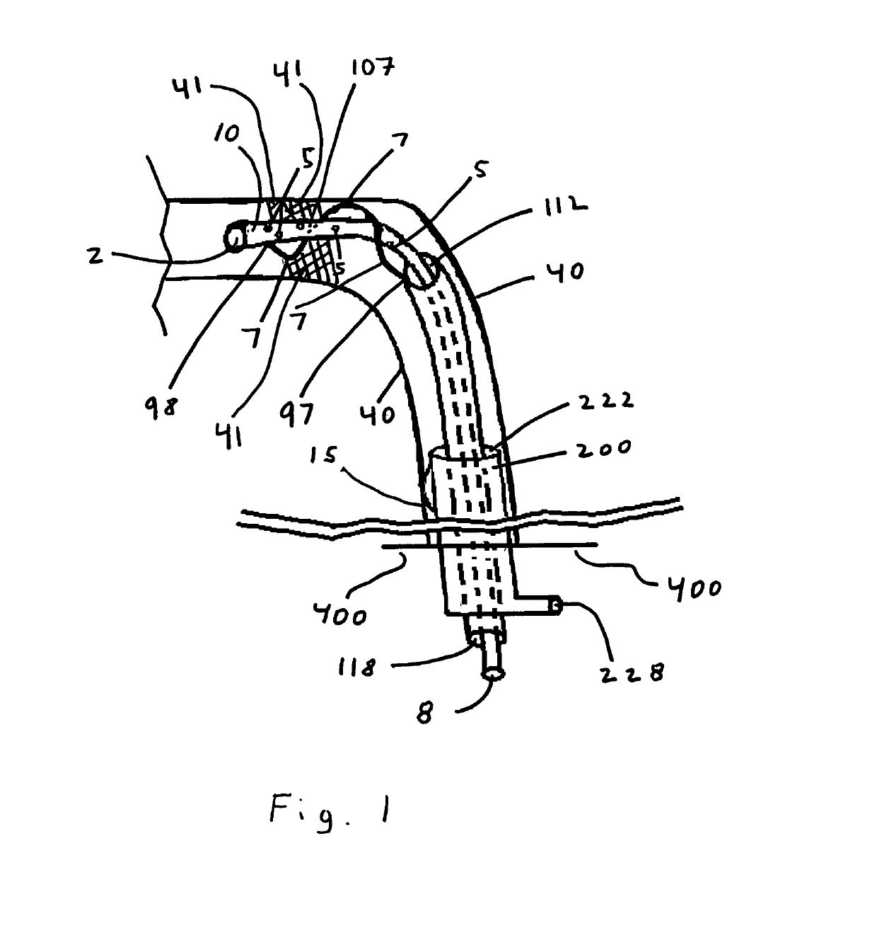 System and method for clot amelioration