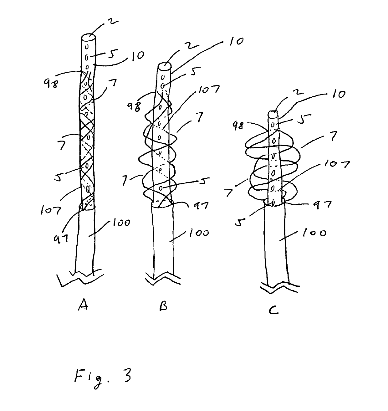 System and method for clot amelioration