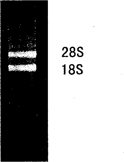 Amphioxus galactose lectin AmphiGAL13-gene and its use