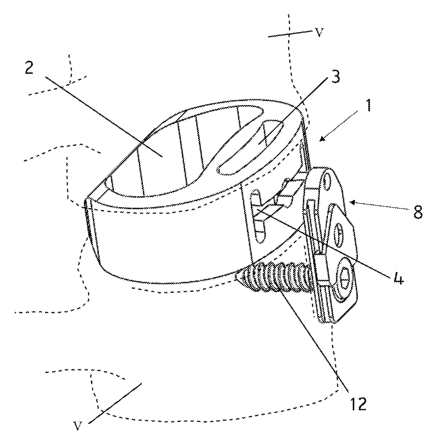 Dynamic interbody cage anchor system