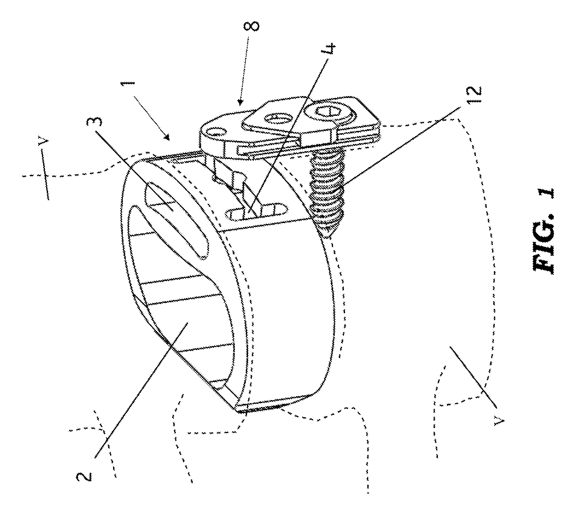 Dynamic interbody cage anchor system