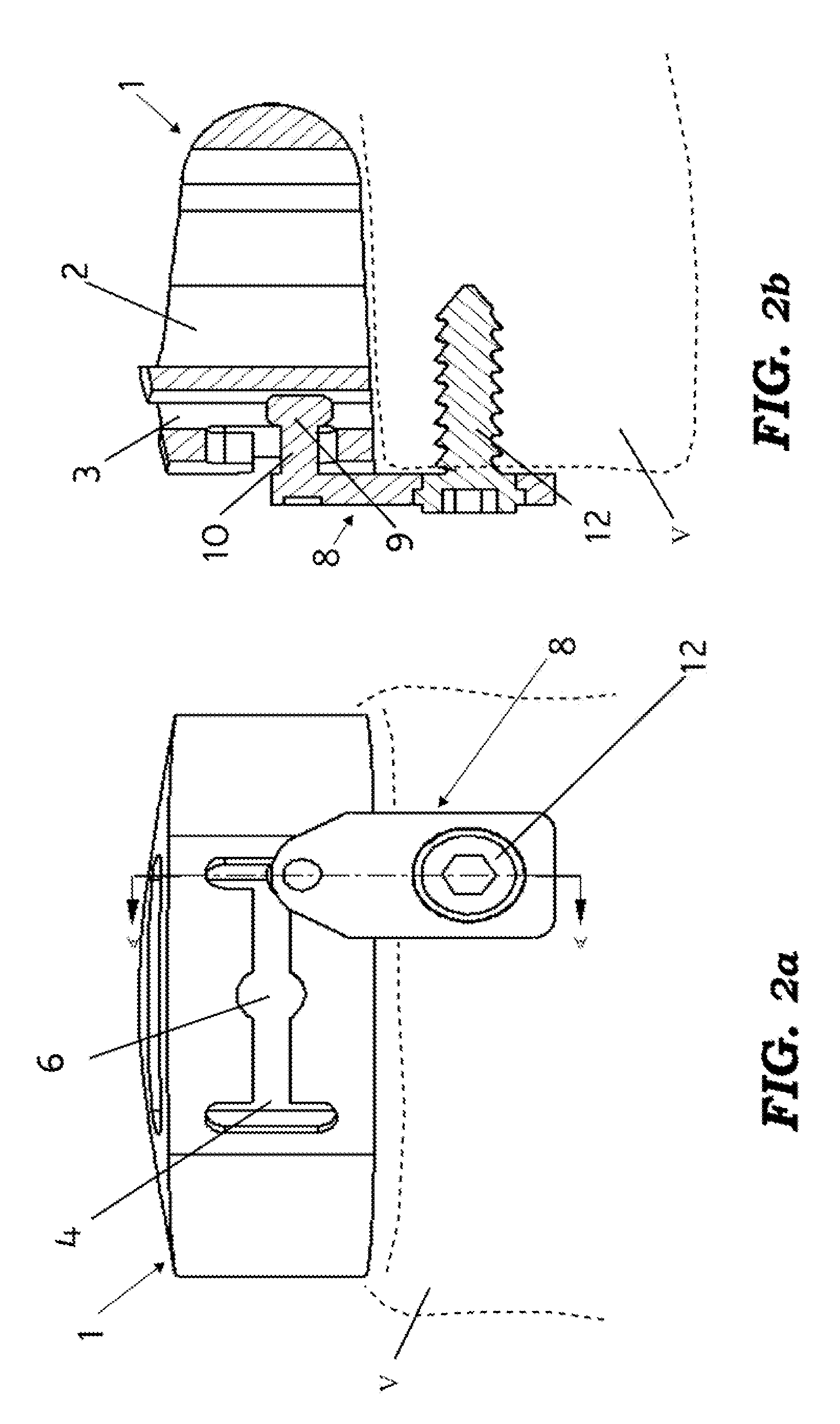 Dynamic interbody cage anchor system