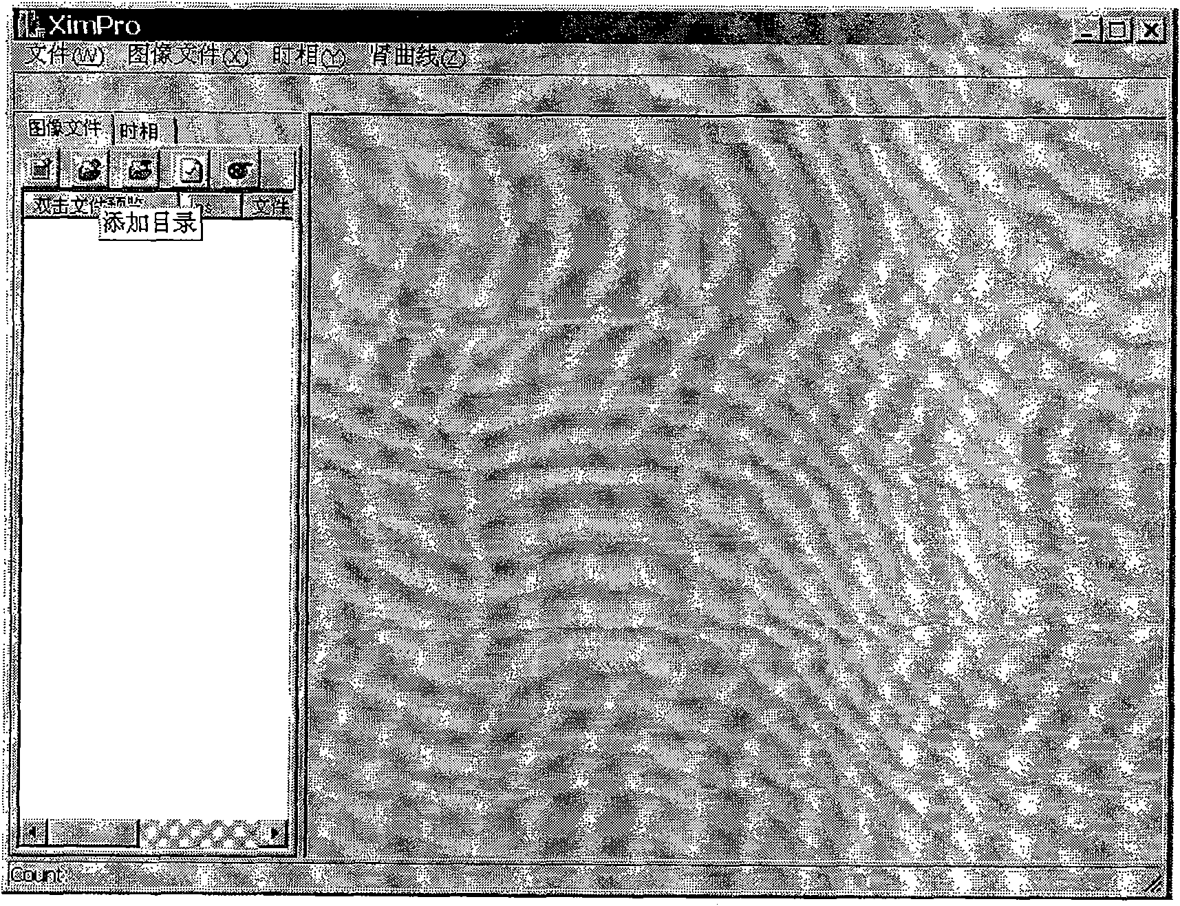 Image processing process based on magnetic resonance three-dimensional renogram