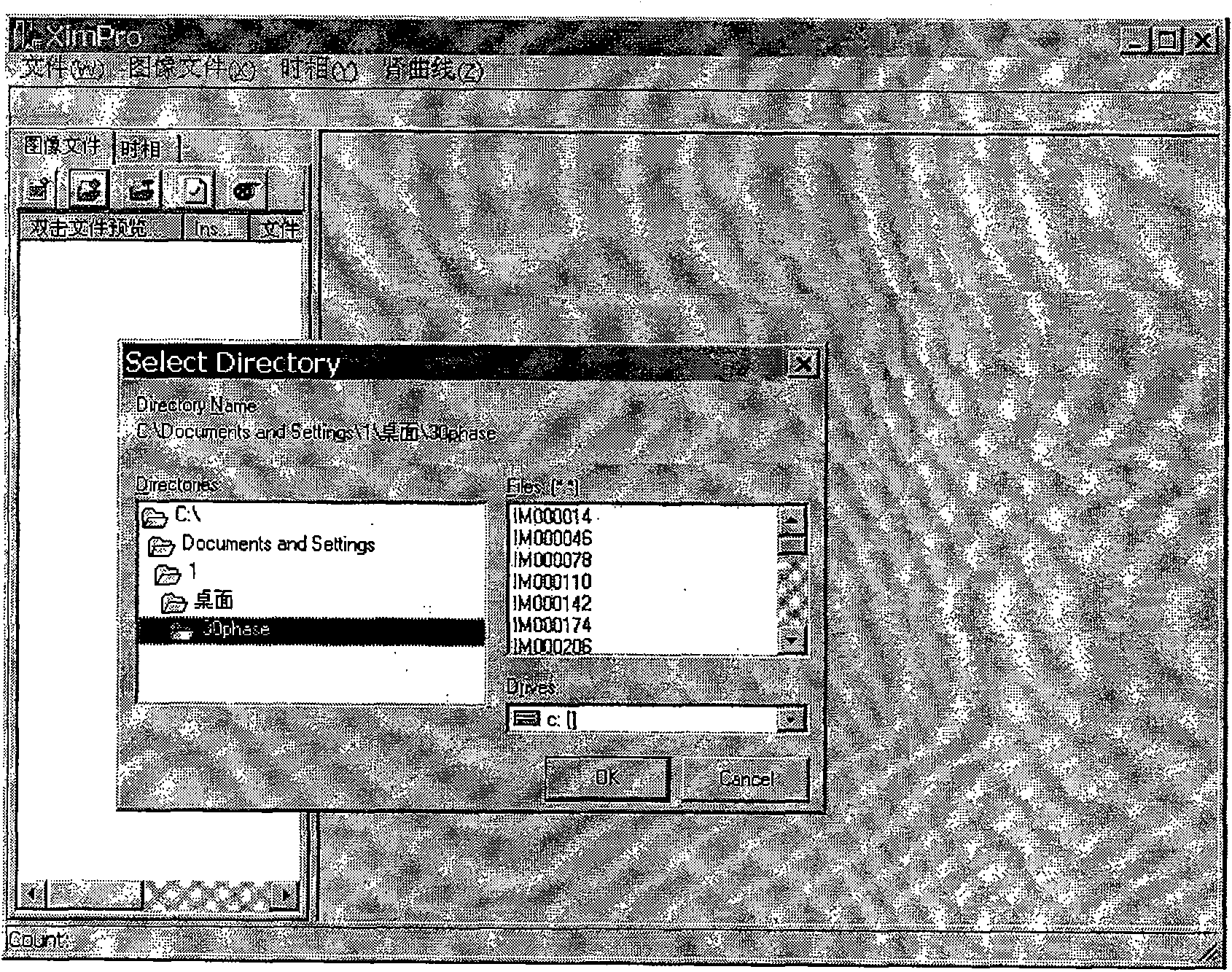 Image processing process based on magnetic resonance three-dimensional renogram