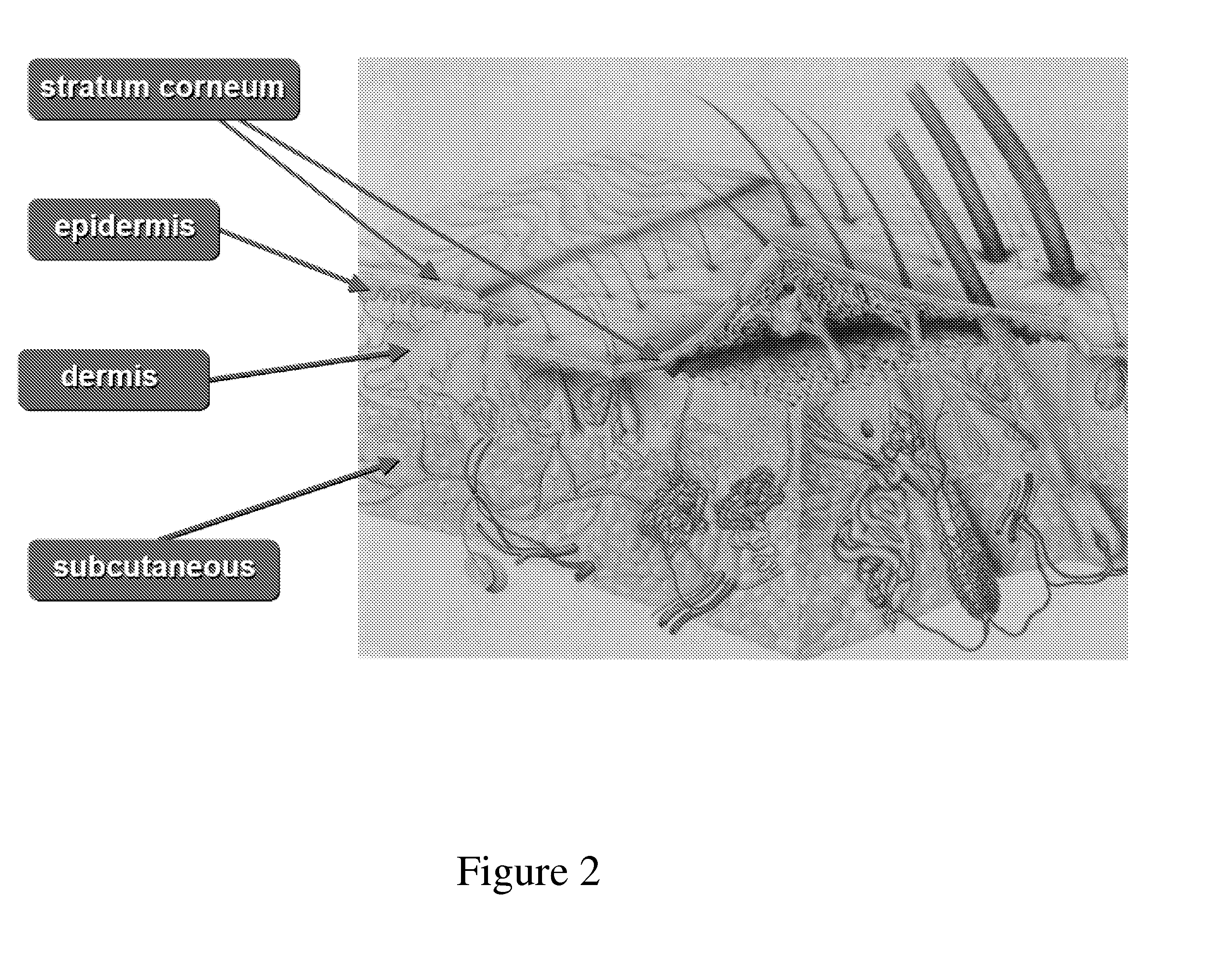 System for Noninvasive Determination of Analytes in Tissue