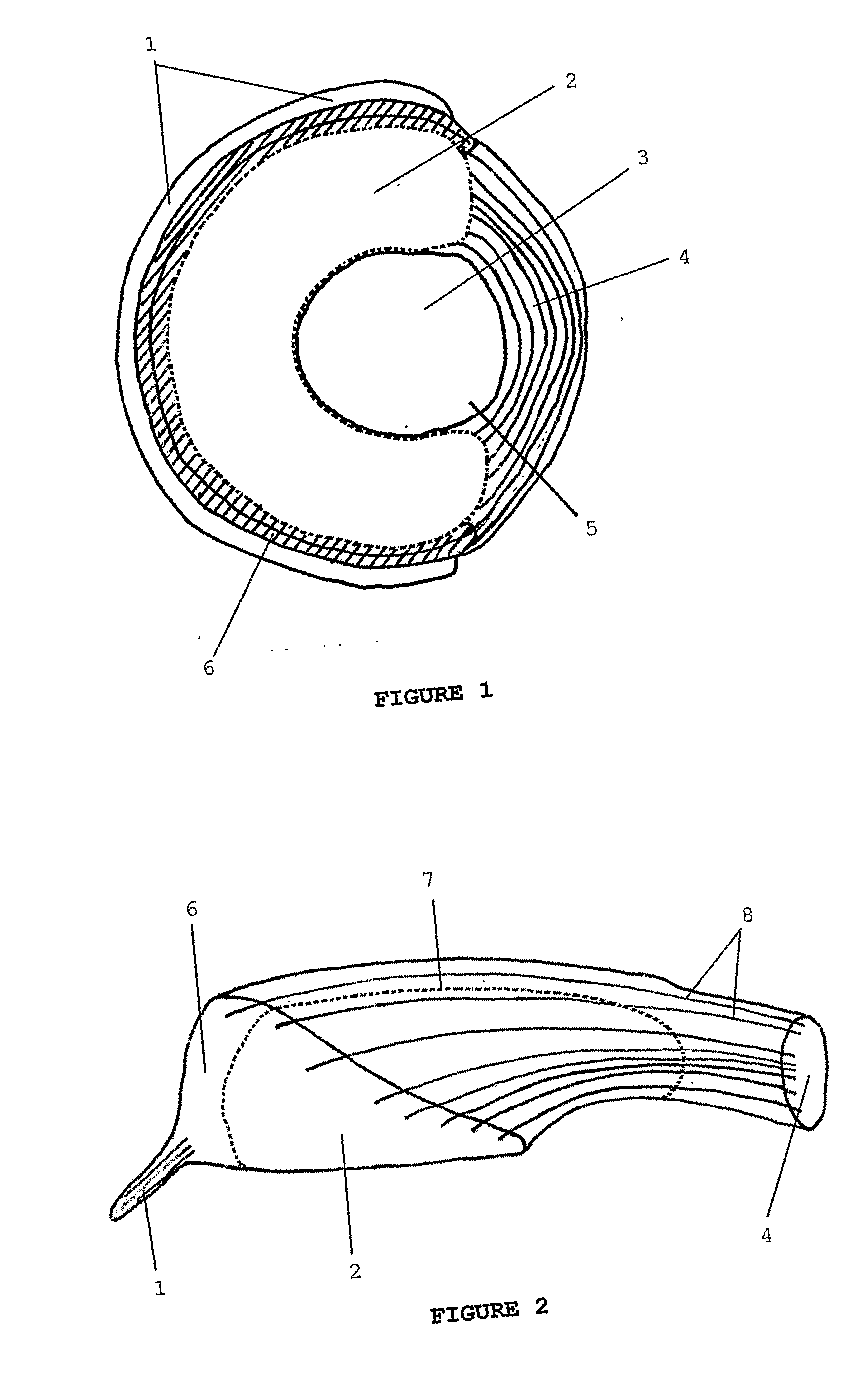 Implantable cartilaginous tissue repair device