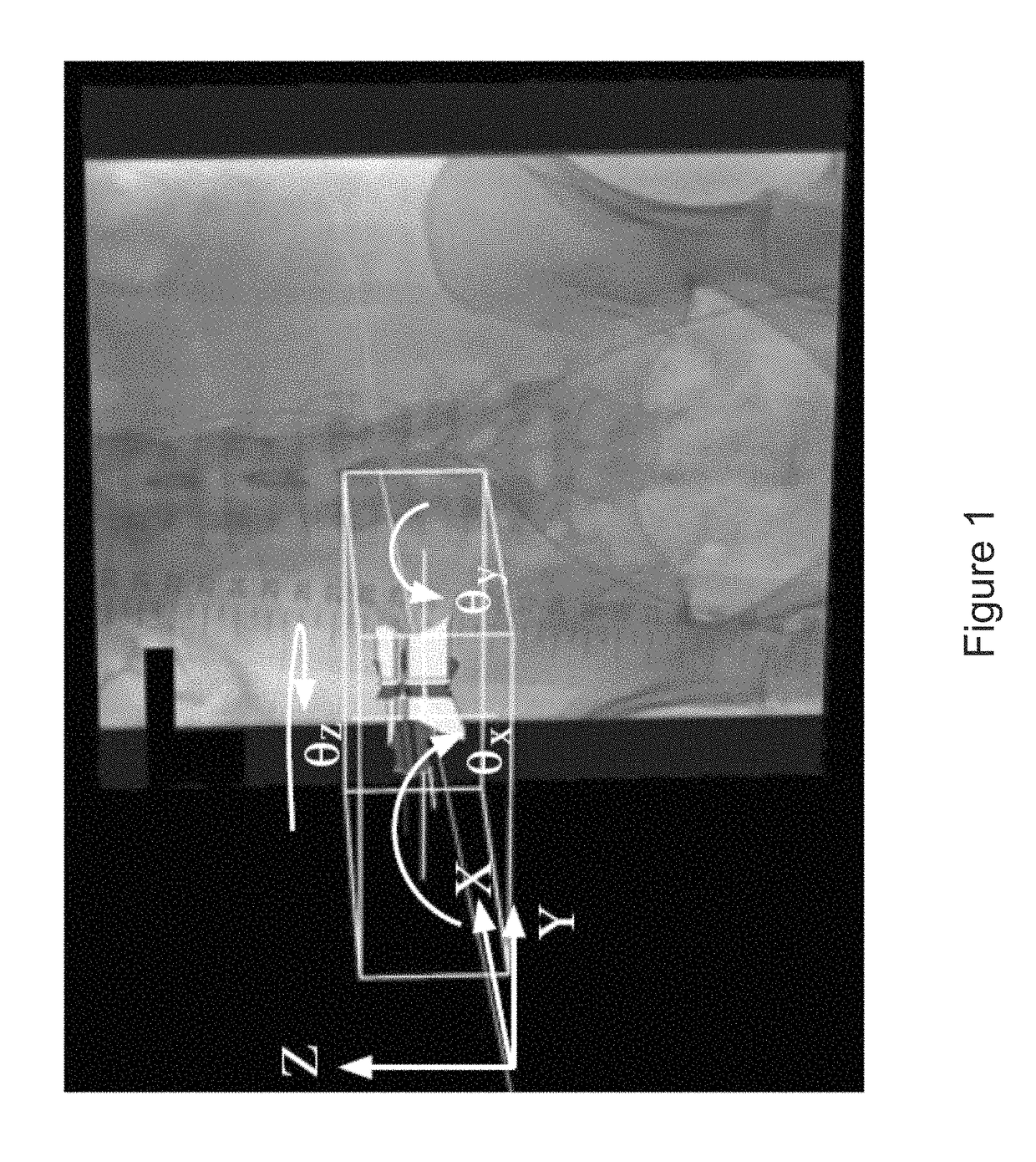 Virtual fiducial markers