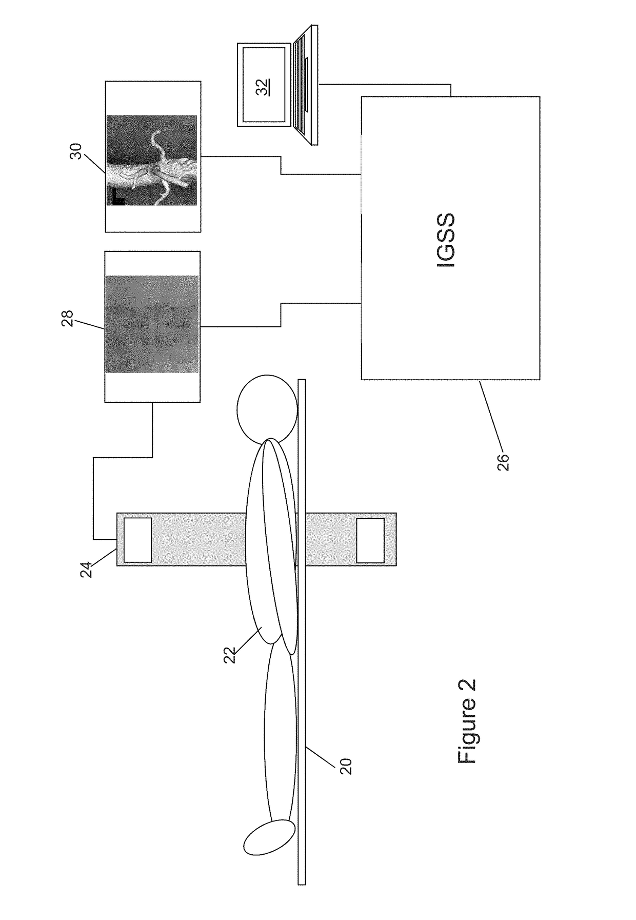 Virtual fiducial markers