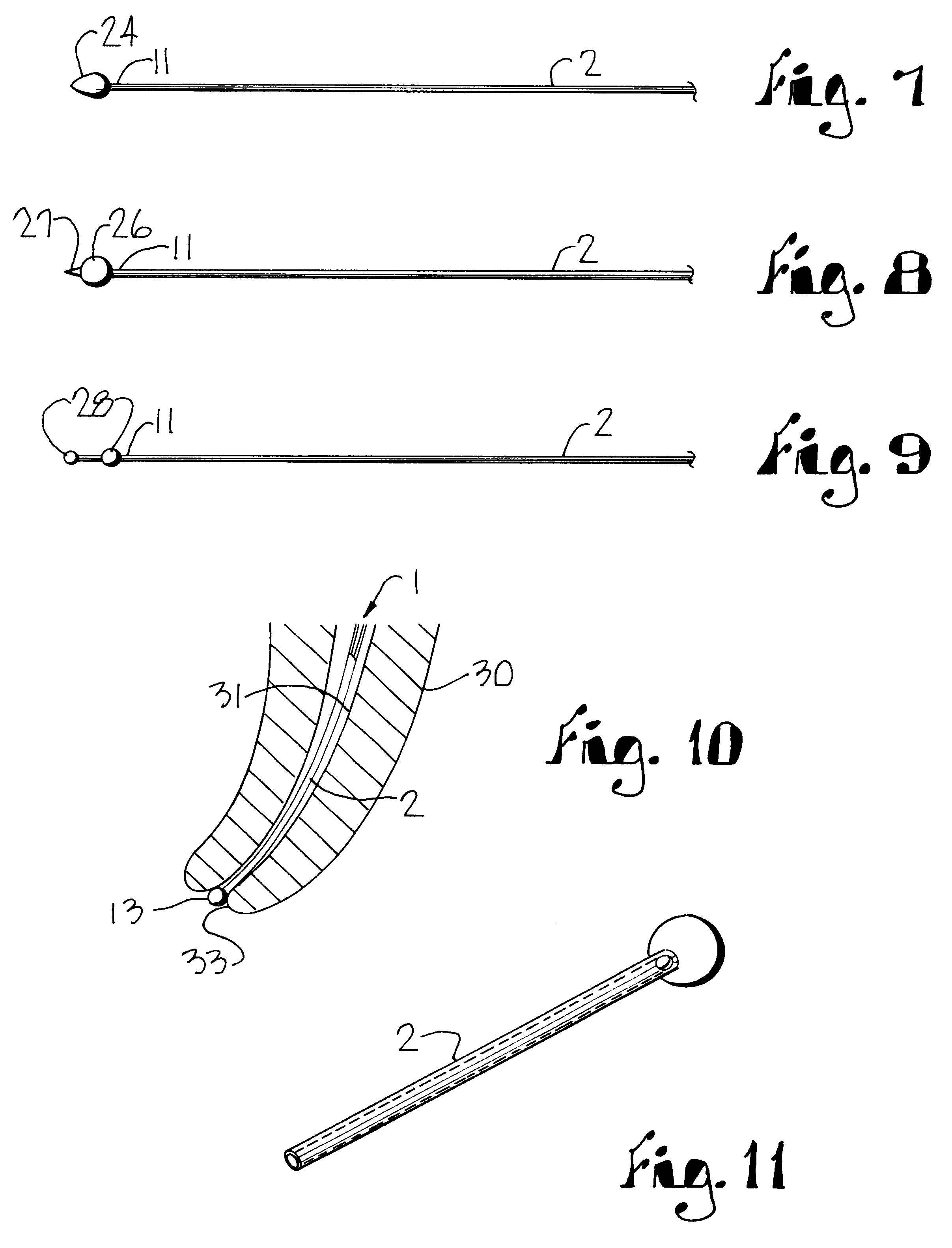 Endodontic probe system