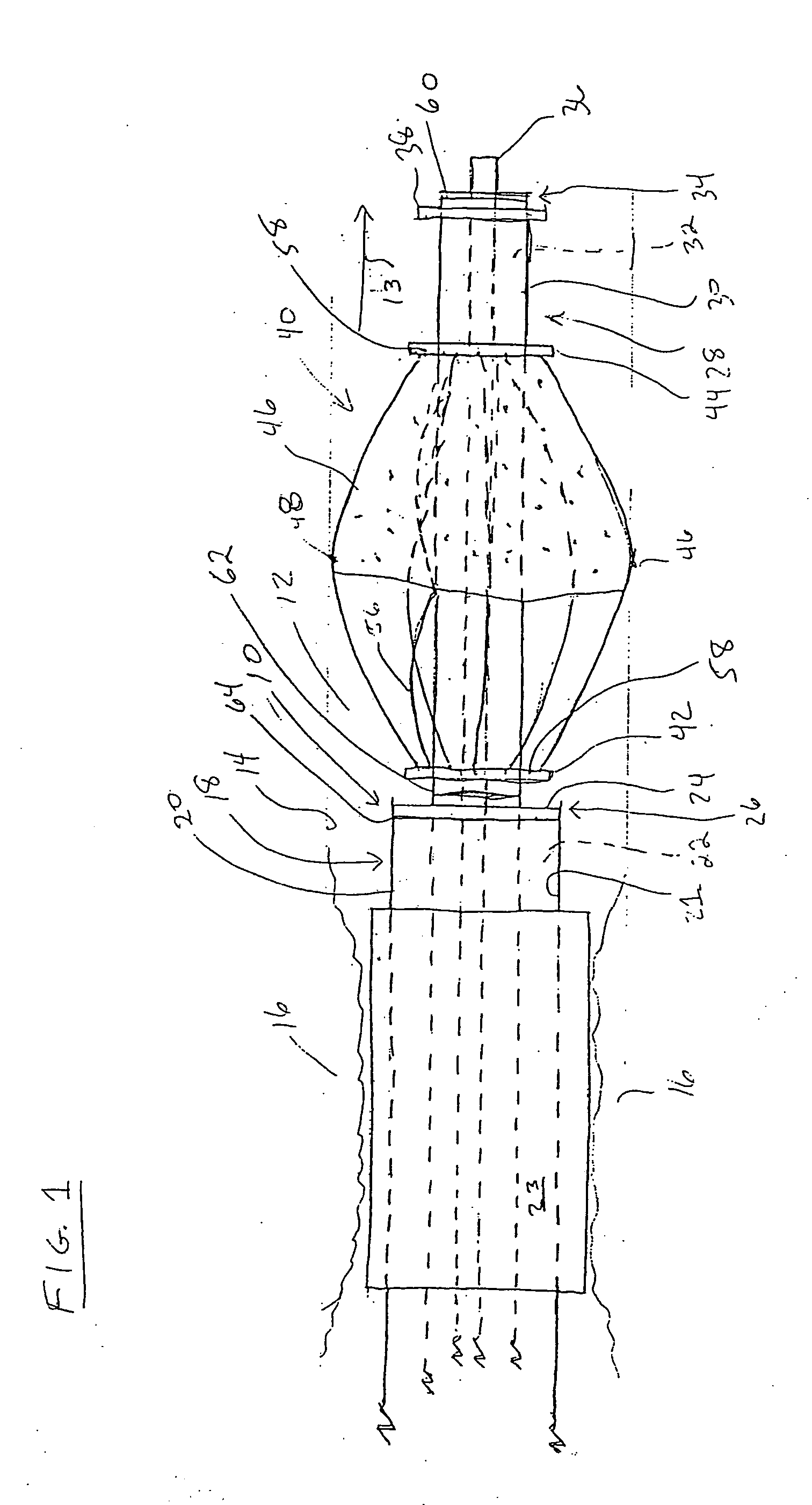 Methods for trapping emboli