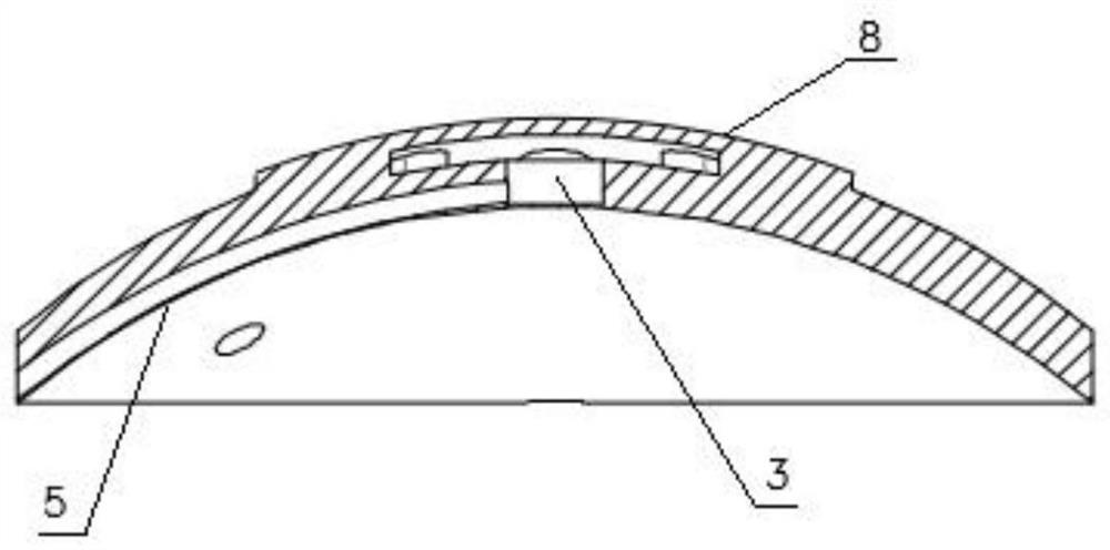 Glaucoma drainage device