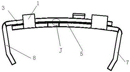 Suprasternal plate