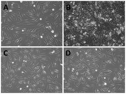 A kind of human glioma cell line and its establishment method and application