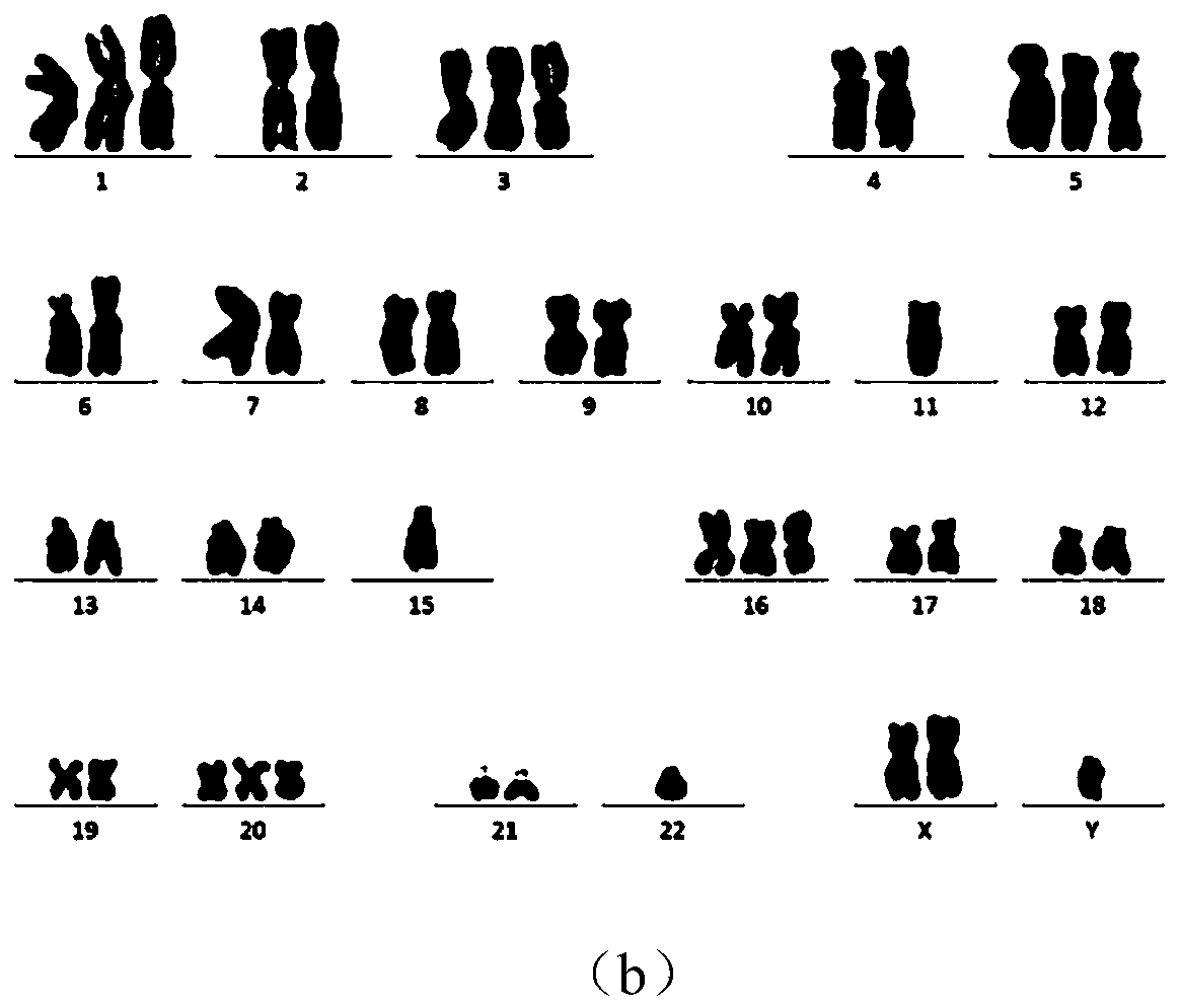 A kind of human glioma cell line and its establishment method and application