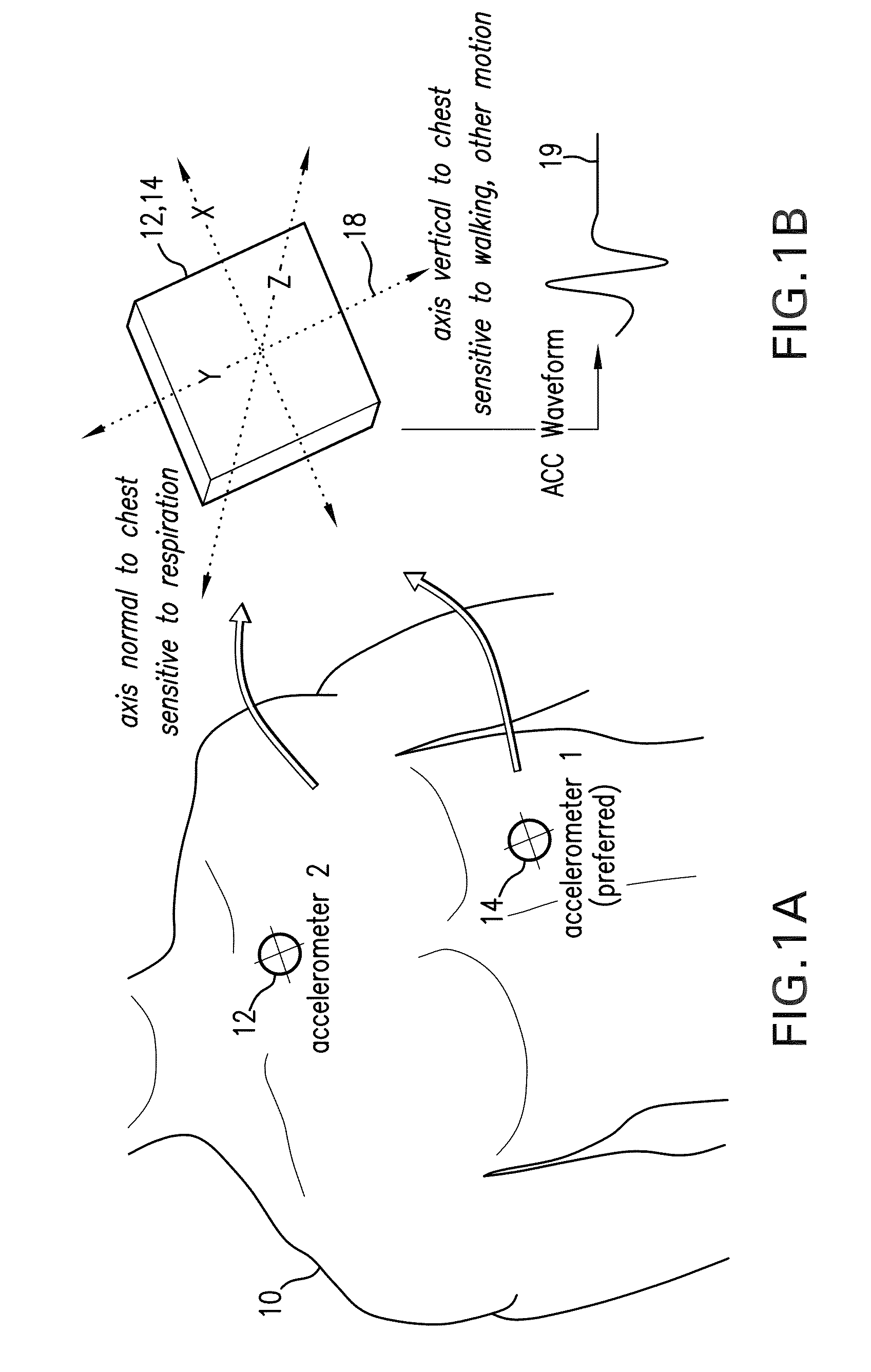 Body-worn monitor for measuring respiration rate