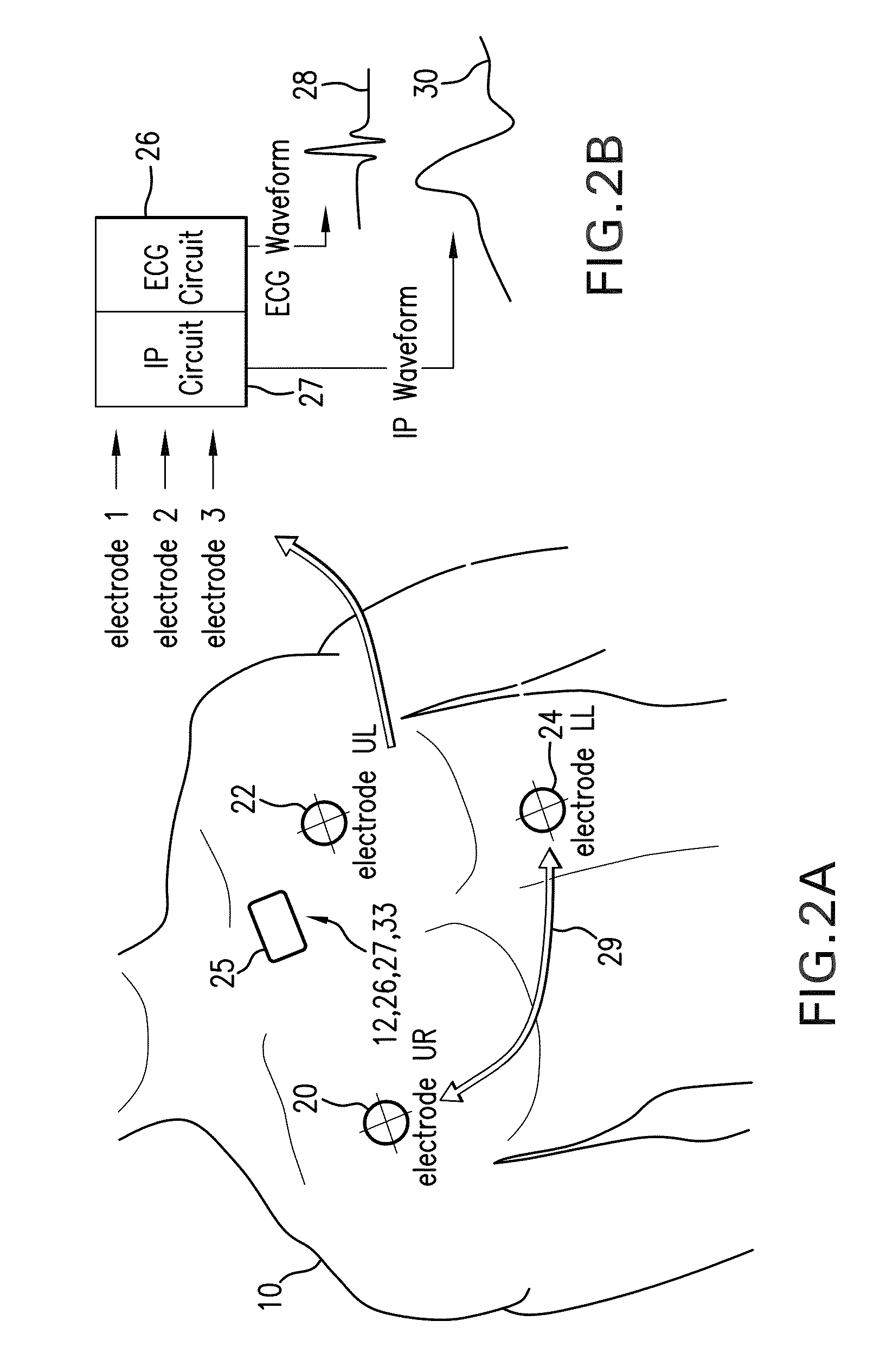 Body-worn monitor for measuring respiration rate