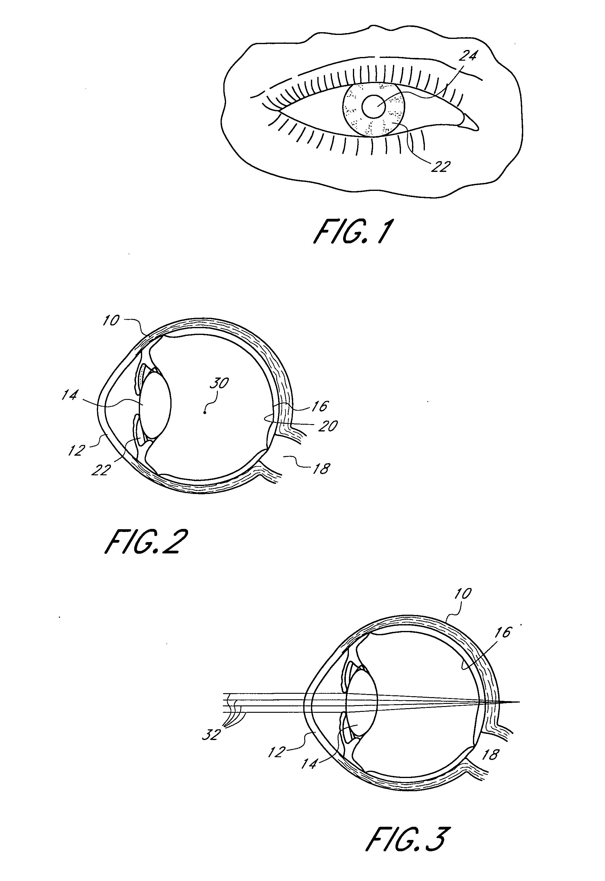 Mask configured to maintain nutrient transport without producing visible diffraction patterns