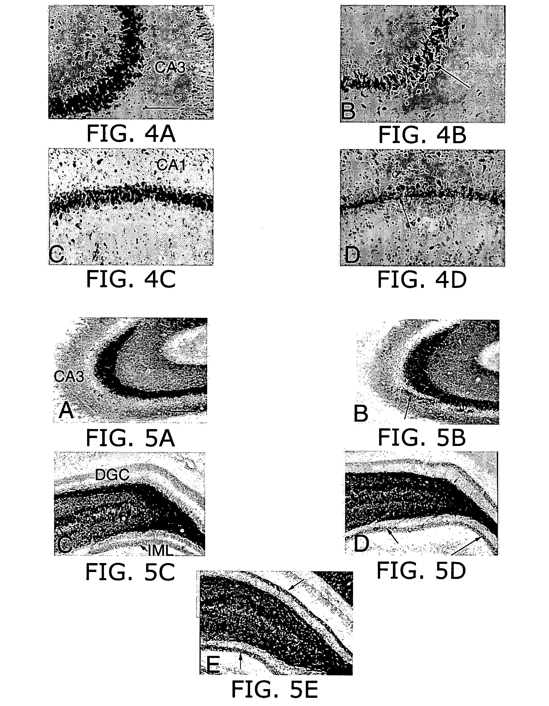 Prolonged suppression of electrical activity in excitable tissues