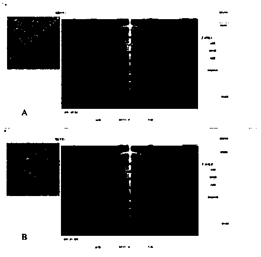 Method for expressing corneal irregularity structure changes based on change consistency parameters of anterior segment tomography technology