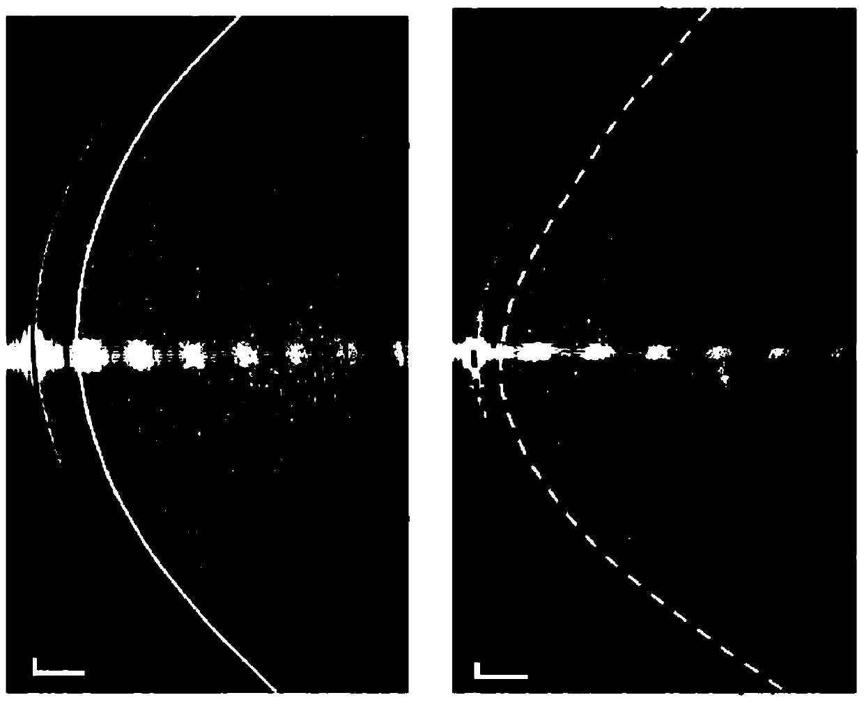 Method for expressing corneal irregularity structure changes based on change consistency parameters of anterior segment tomography technology