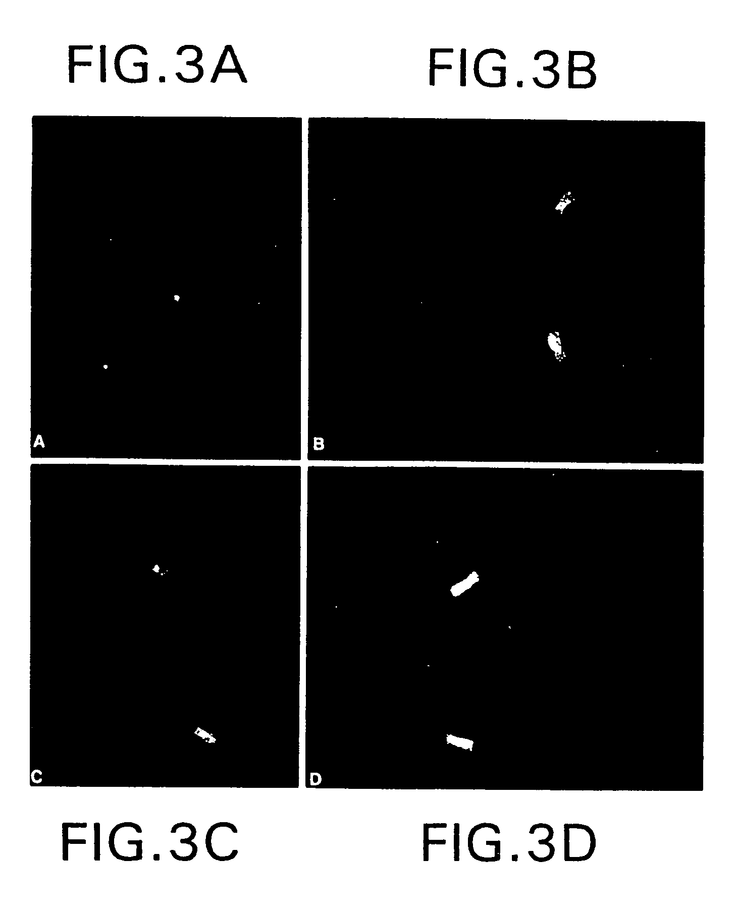 Delineation of individual human chromosomes in metaphase and interphase cells by in situ suppression hybridization