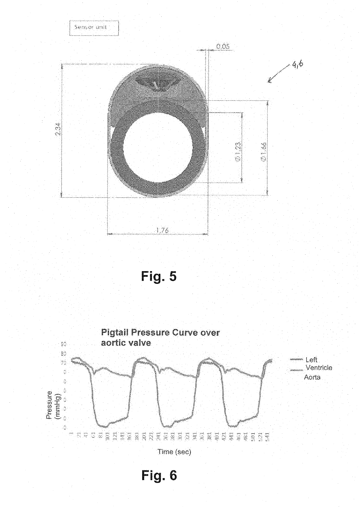 Dual Pressure Sensor Aortic-Valve Catheter