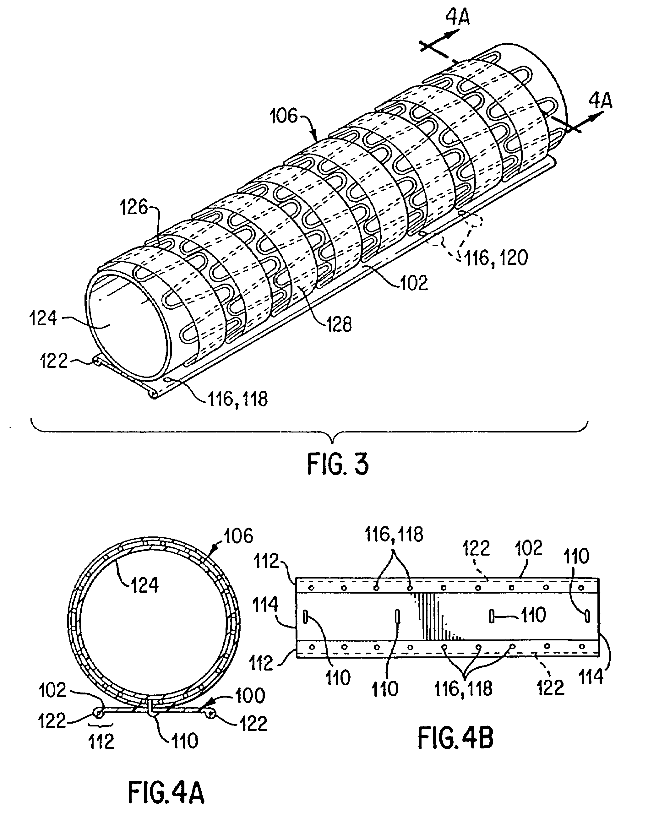 Kink-resistant bifurcated prosthesis