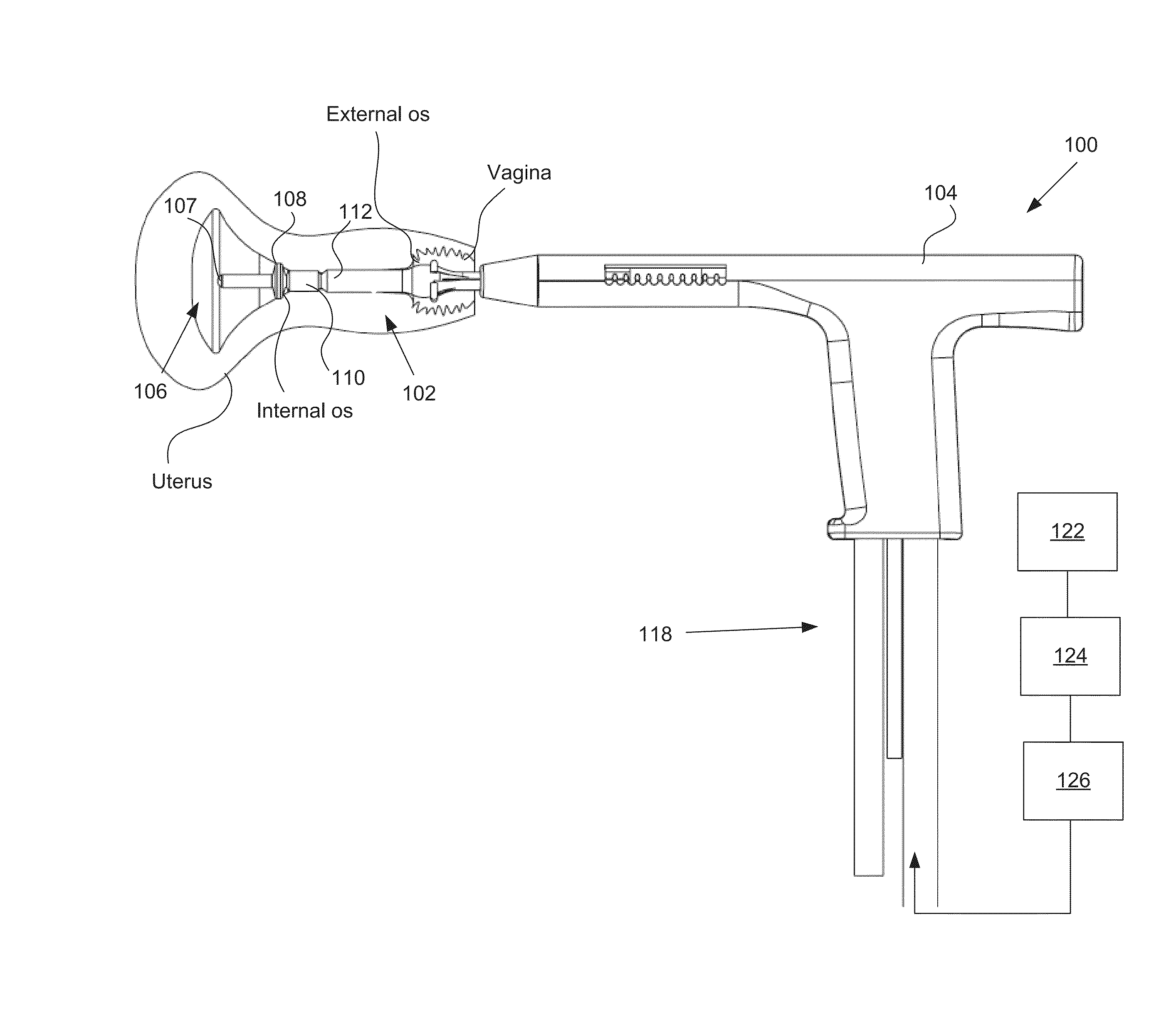 Integrity Testing Method and Apparatus for Delivering Vapor to the Uterus